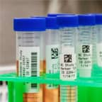 Kriyojenik depolama için hazırlanan, etiketlere sahip çeşitli test tüpleri.