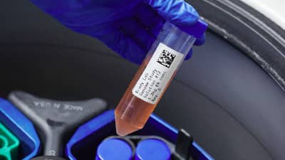 Santrifüj içine takılan bir test tüpü üzerindeki etiket.