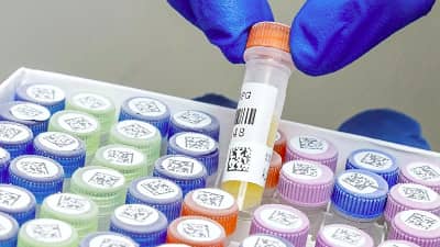 Soğuk depolama için hazırlanan, Brady freezerbond etiketlerine sahip laboratuvar numuneleri.