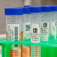 QR kodlarıyla etiketlenen birden fazla numune.