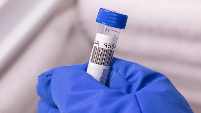 2D barkodla etiketlenen bir numune.