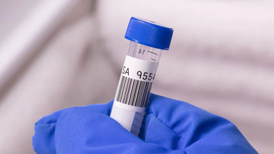 Brady kriyojenik polyester etiketinin yapıştırıldığı bir test tüpünü tutan laboratuvar teknisyeni. Etiket üzerinde basılı hem metin hem de barkod bulunur.